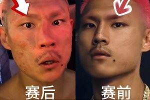 惨遭“整容”！恶鼠遭威姆斯TKO 鼻梁骨被打歪鲜血直流🤕